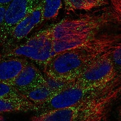 TPK1 Antibody, Novus Biologicals 0.1mL; Unlabeled:Antibodies, Polyclonal